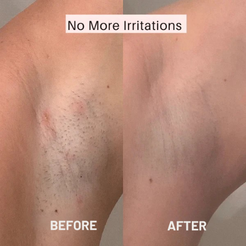 Naisten partakone – Sileä iho ilman ärsytystä 